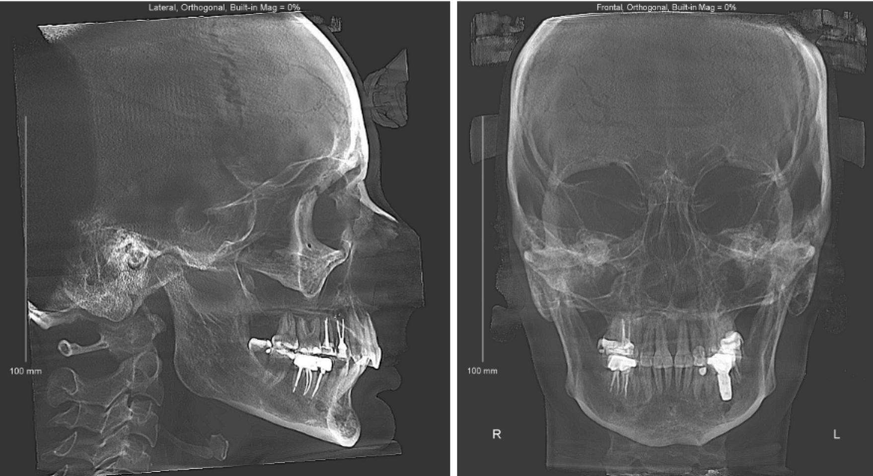 Каждая из этих проекций дает важную информацию для постановки диагноза.